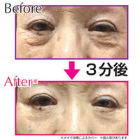 眼周緊緻精華 複合聚合物被膜 8種美容成分 18ml｜目のたるみピーンとハリ！ ピーンクイック